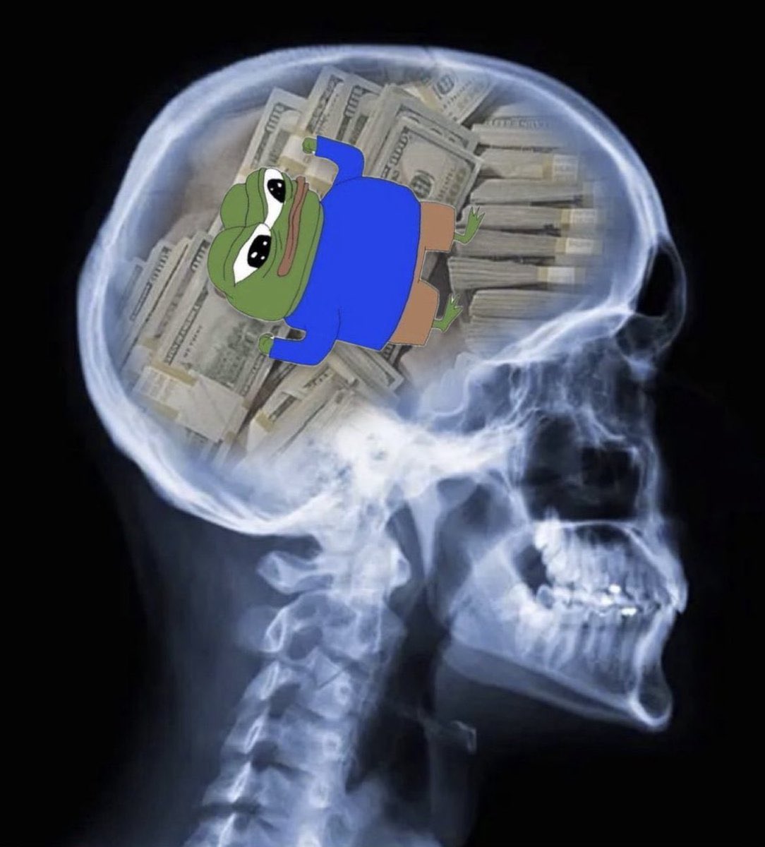 X-ray of a head with Apu and stacks of cash inside